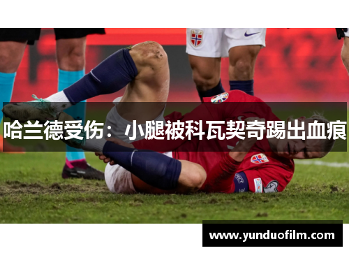 哈兰德受伤：小腿被科瓦契奇踢出血痕